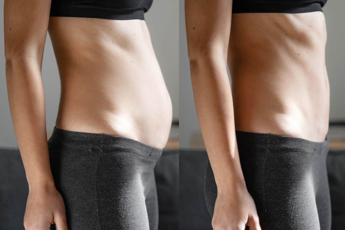 Post-Pregnancy: What Happens to Your Abdominal Muscles After Birth Epping