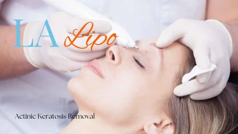 Woman receiving Actinic Keratosis Removal Treatment Epping