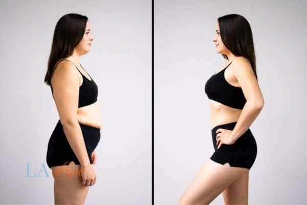 LA-EMS Body Sculpting Epping results before and after of womans results on body toning.