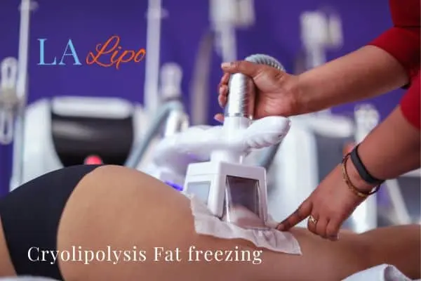 women getting fat freezing Epping