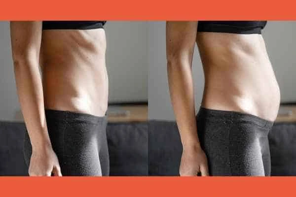 LA-EMS Body Sculpting results Epping