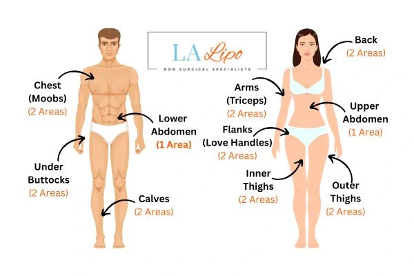 LA LIPO Cryolipolysis Areas Epping