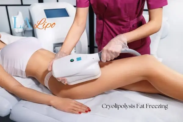 Woman receiving coolsculpting Epping treatment on her thighs