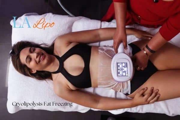 woman getting cryolipolysis Epping