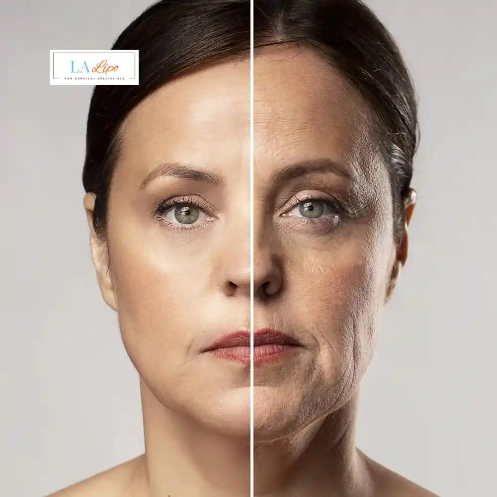How Can You Tell If Non-Surgical Skin Tightening Is Right for You Epping?