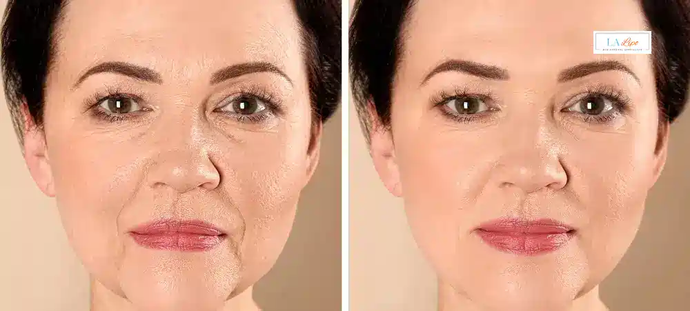 How Long Does It Take to See Results and How Long Do They Last Epping?