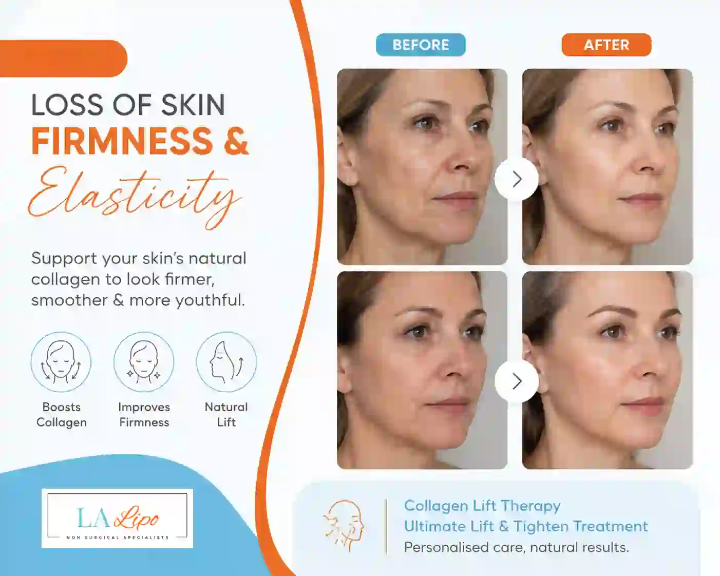 Sign #7: Loss of Skin Firmness and Elasticity Epping