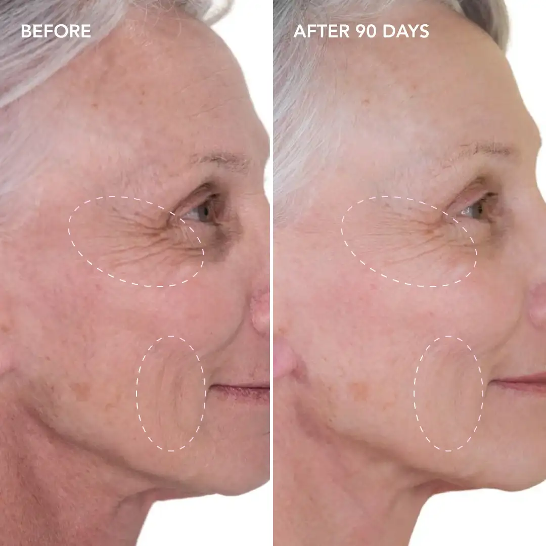 When will you see results Epping